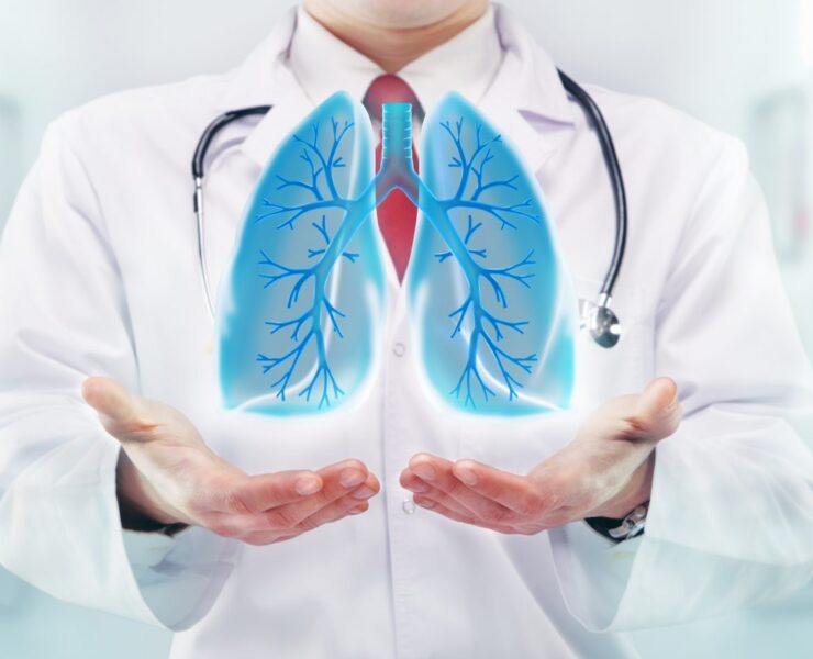 Idiopathic Pulmonary Fibrosis - Best Idiopathic Pulmonary Fibrosis Doctor Gurgaon