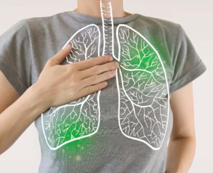 Pulmonary Fibrosis Doctor in Gurgaon - Dr Shivanshu Raj Goyal