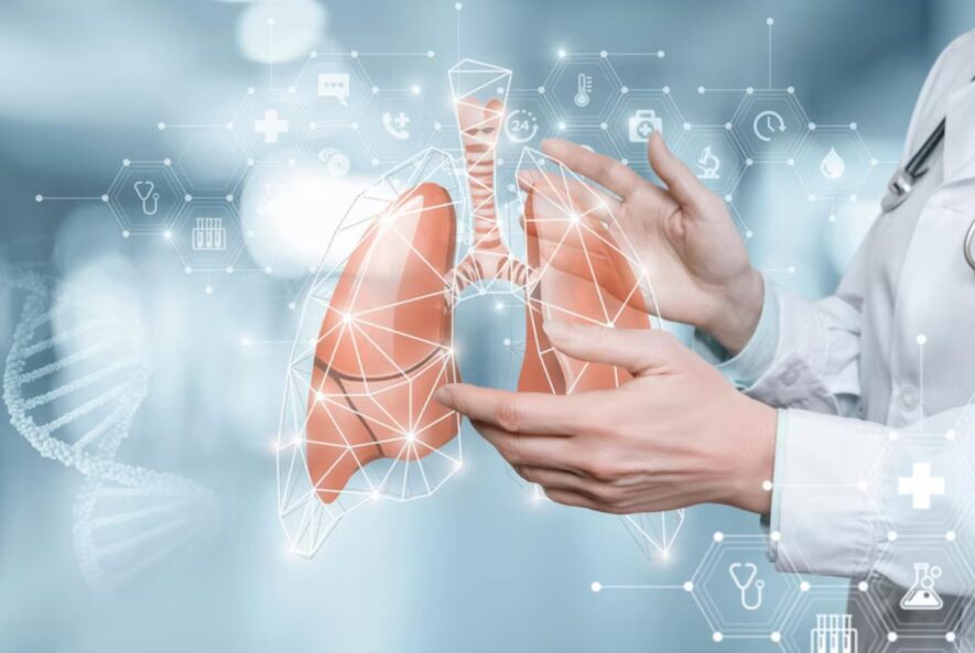 Tips To Choose Top Lung Doctor in Gurgaon - Dr Shivanshu Goyal