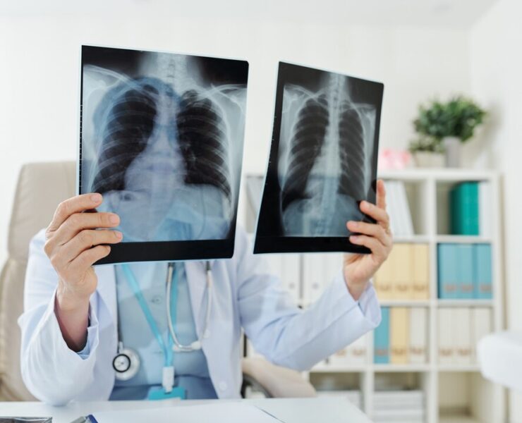 Pulmonologist in Gurgaon - Expert Respiratory Care - Dr Shivanshu