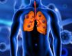 Top 10 Signs You Should See a Pulmonologist in Gurgaon
