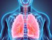 What Causes Water in the Lungs? Symptoms and Treatment Options