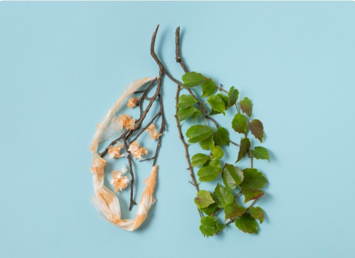 Best Lung Specialist in Dwarka - Dr Shivanshu Raj Goyal