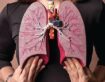 Advanced COPD Treatments: How Pulmonologists Are Improving Quality of Life