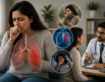 Chronic Cough That Won’t Go Away? When to See a Pulmonologist